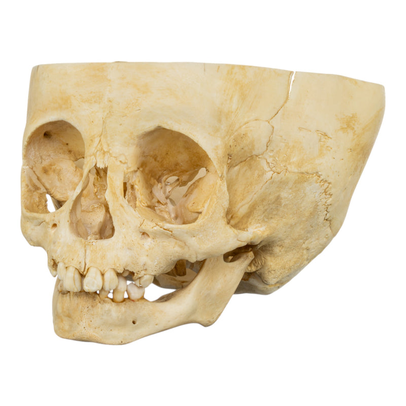 Real Human Child Skull - Partial