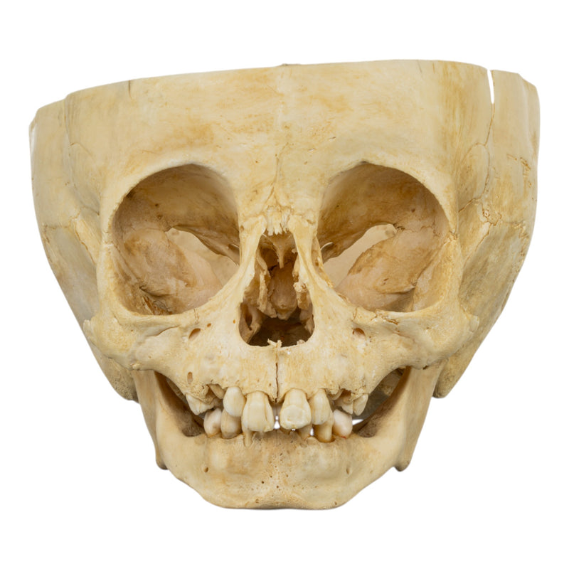 Real Human Child Skull - Partial
