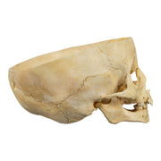 Real Human Child Skull - Partial