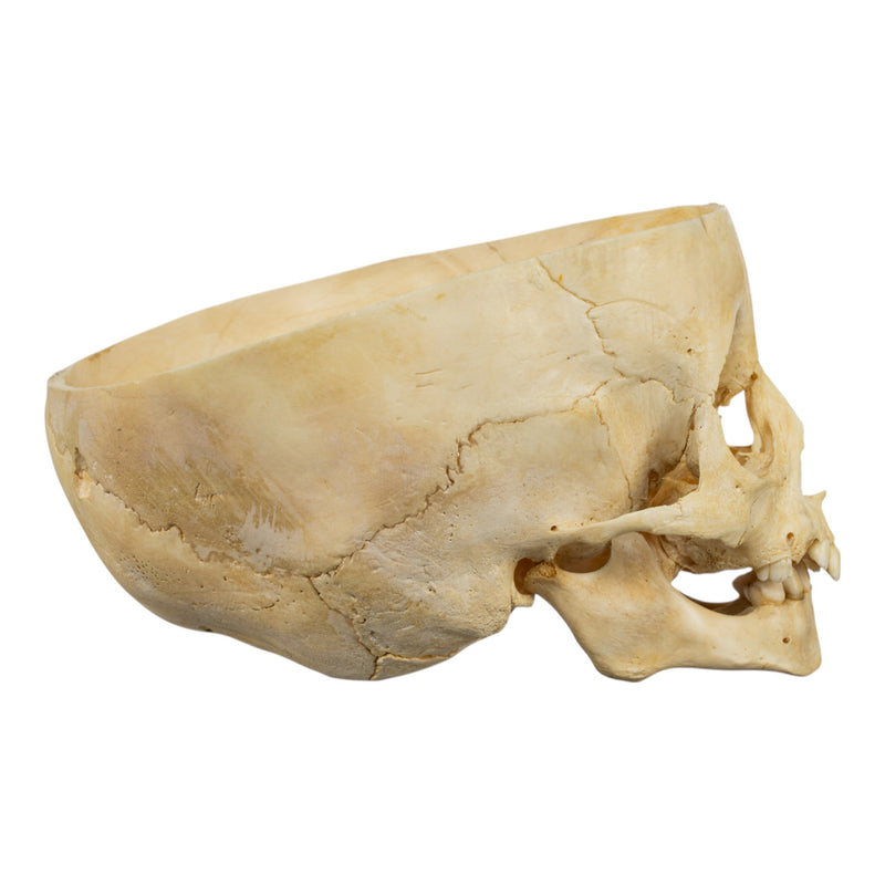 Real Human Child Skull - Partial