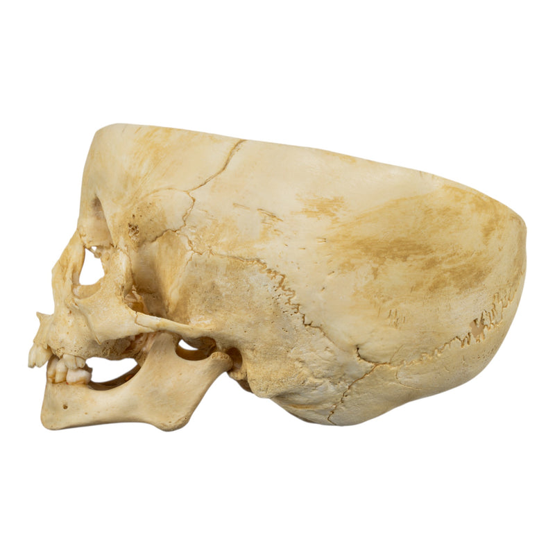 Real Human Child Skull - Partial