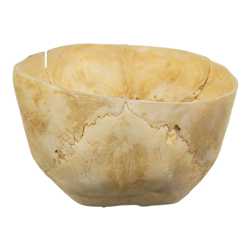 Real Human Child Skull - Partial