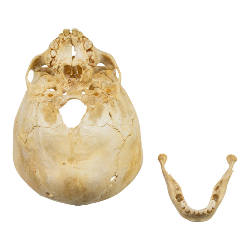 Real Human Child Skull - Partial