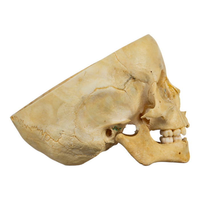 Real Human Child Skull - Partial