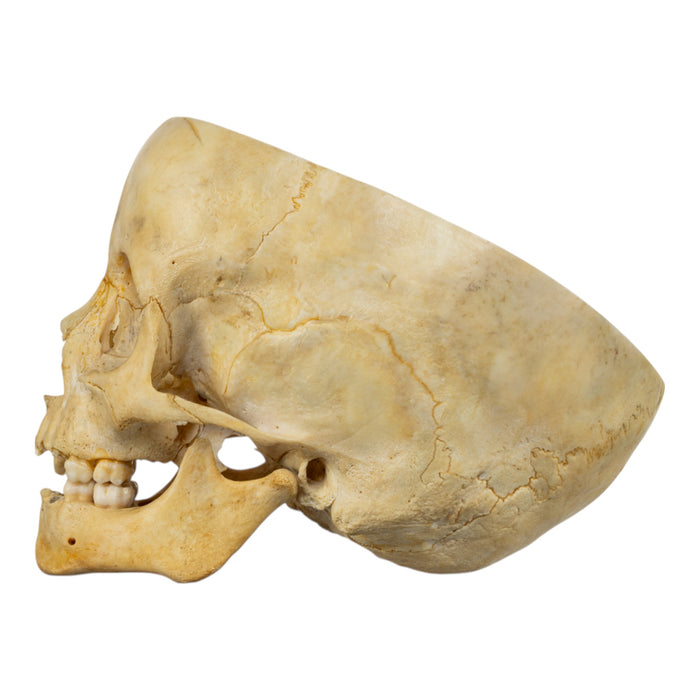 Real Human Child Skull - Partial