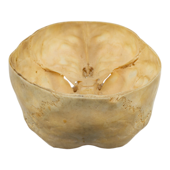 Real Human Child Skull - Partial