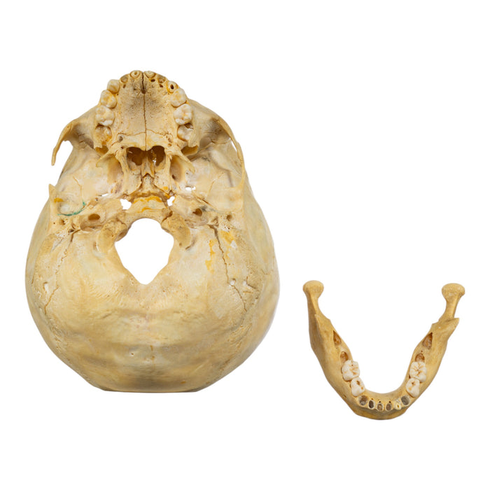 Real Human Child Skull - Partial
