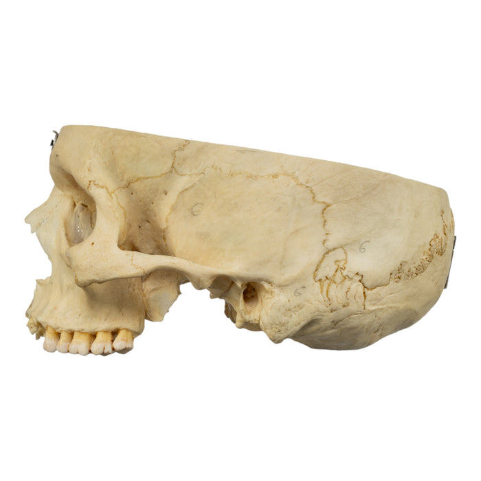 Real Human Skull - Partial
