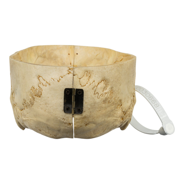 Real Human Skull - Partial