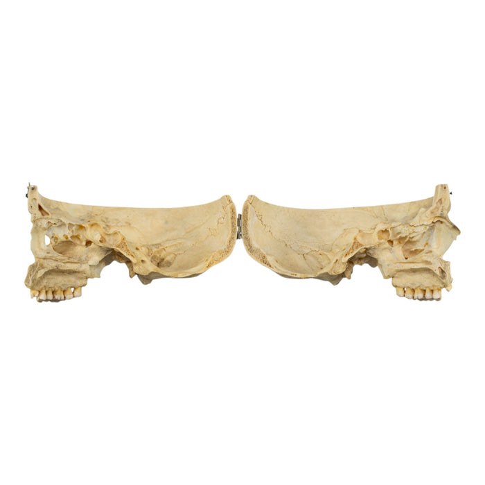Real Human Skull - Partial