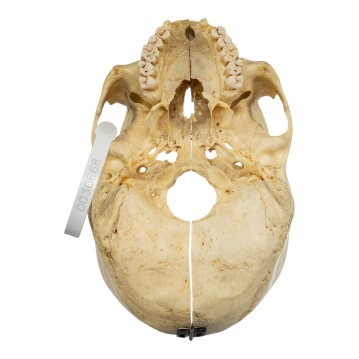 Real Human Skull - Partial