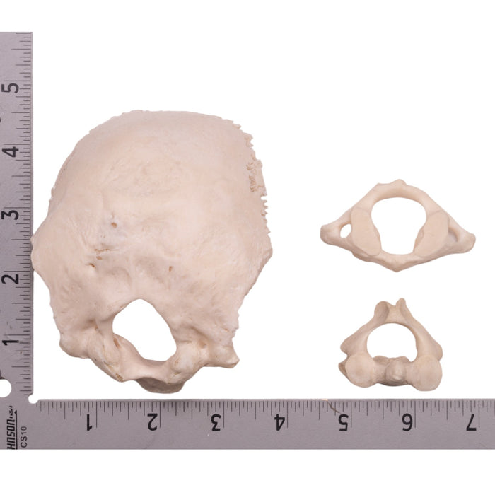 Real Human Occipital Bone, Atlas, and Axis