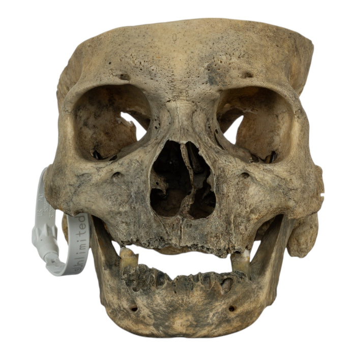 Real Human Skull - Partial