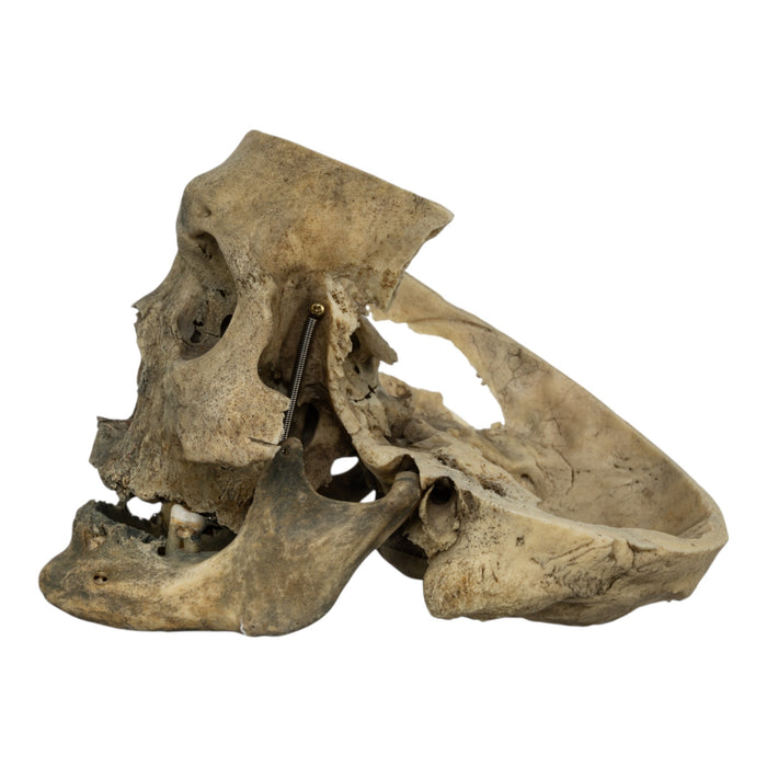 Real Human Skull - Partial