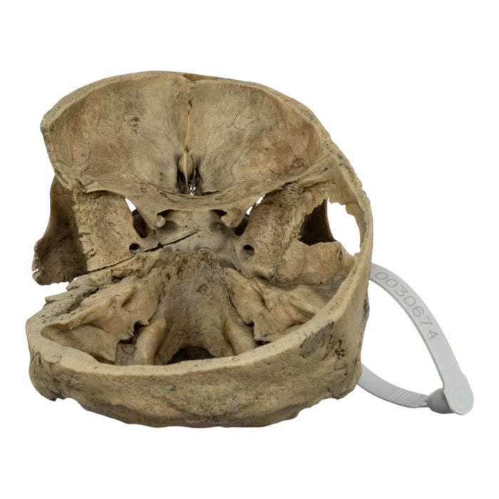 Real Human Skull - Partial