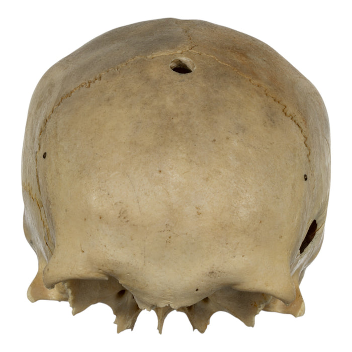 Real Human Skull - Partial