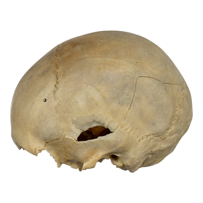 Real Human Skull - Partial