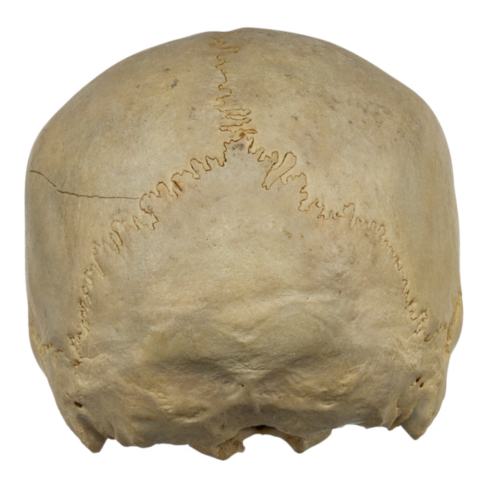 Real Human Skull - Partial
