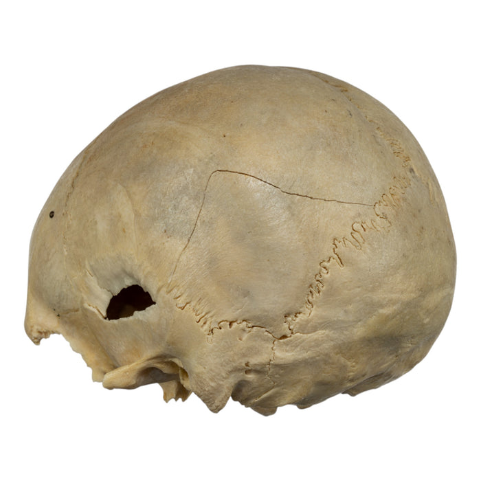 Real Human Skull - Partial