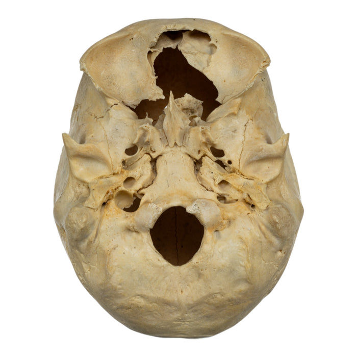 Real Human Skull - Partial