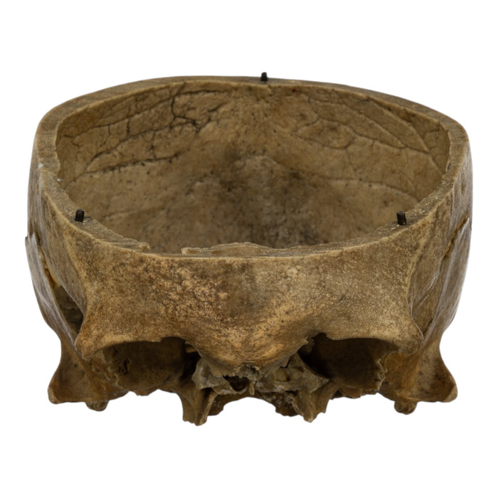 Real Human Skull - Partial