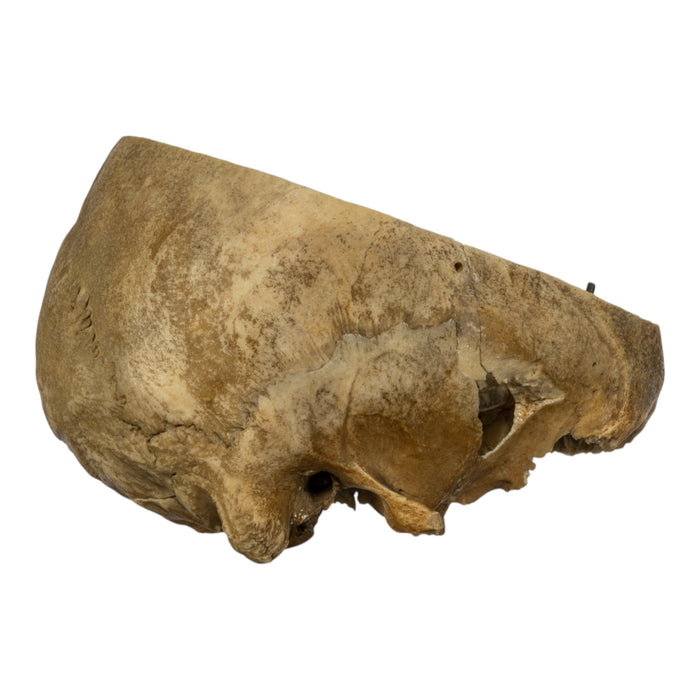 Real Human Skull - Partial