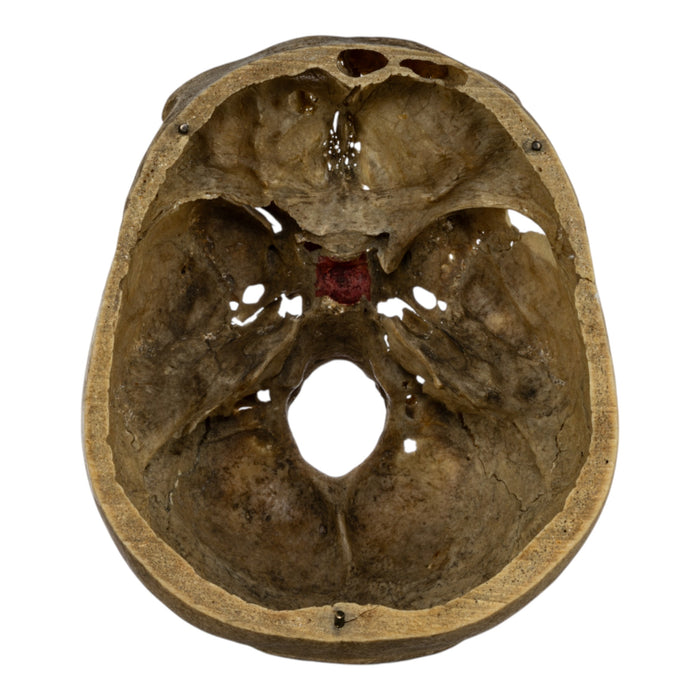 Real Human Skull - Partial