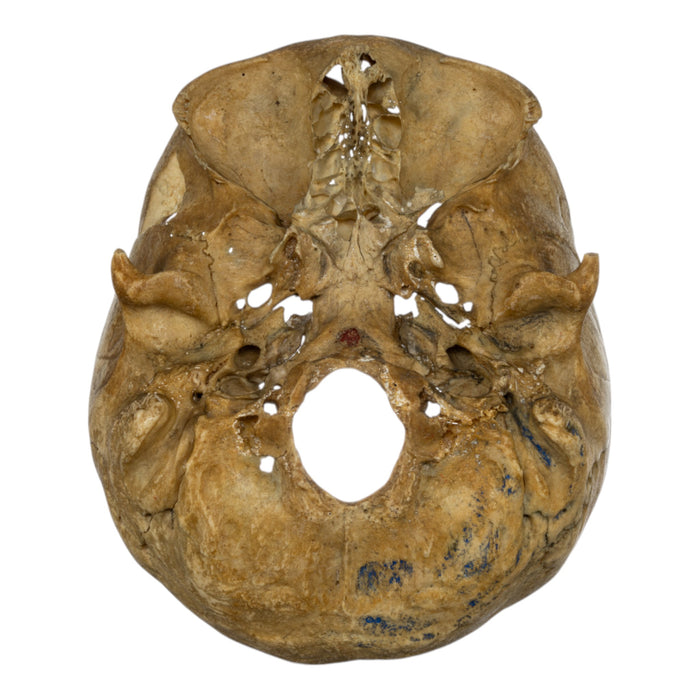 Real Human Skull - Partial