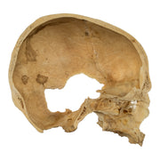 Real Human Skull - Partial