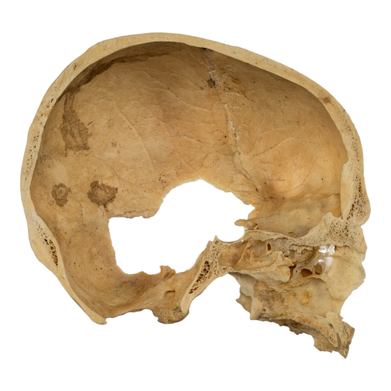 Real Human Skull - Partial