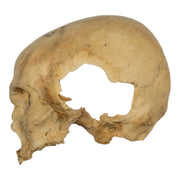 Real Human Skull - Partial