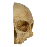 Real Human Skull - Partial