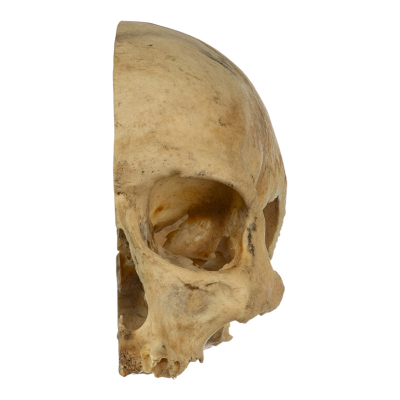 Real Human Skull - Partial
