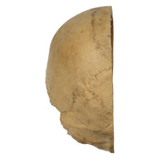 Real Human Skull - Partial