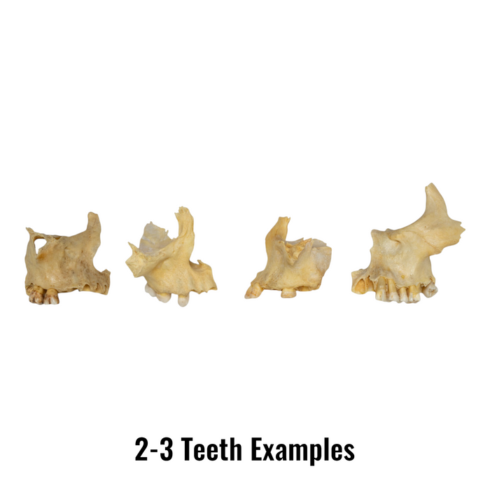 Real Human Maxillary Bone - Single