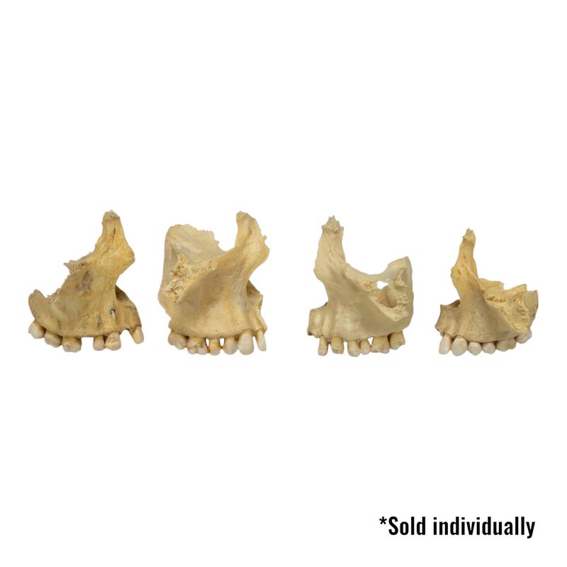 Real Human Maxillary Bone - Antique (Single)