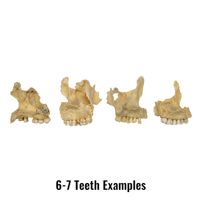 Real Human Maxillary Bone - Single