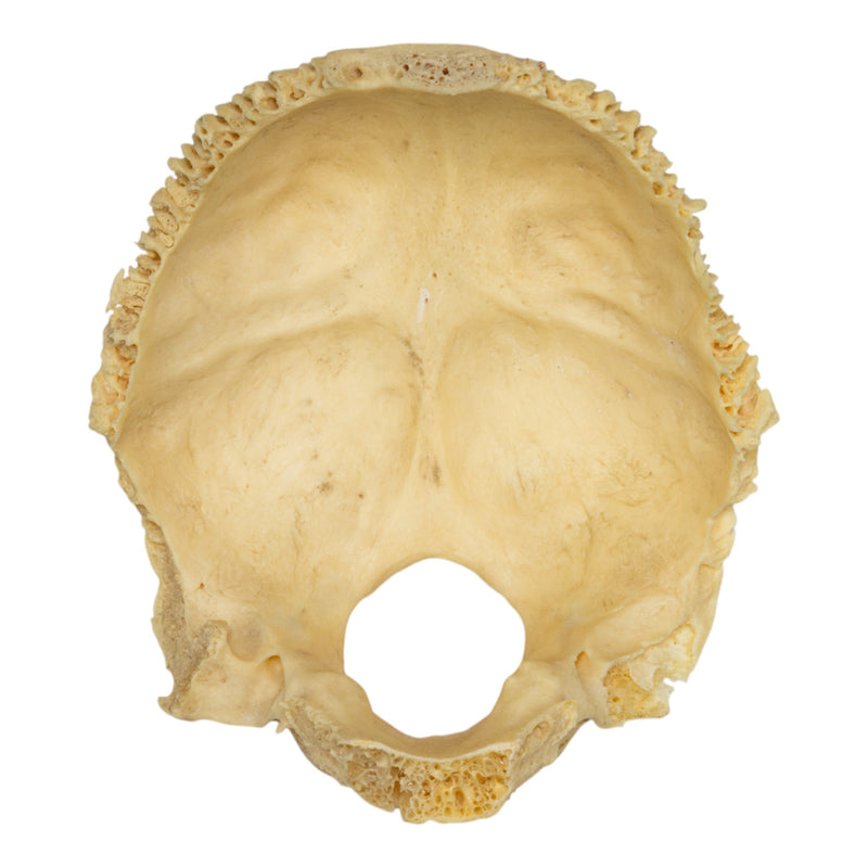 Real Human Occipital Bone - Damaged