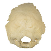 Real Human Occipital Bone - Damaged