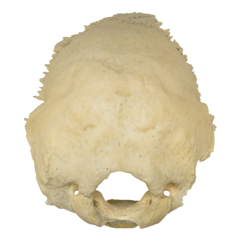 Real Human Occipital Bone - Damaged