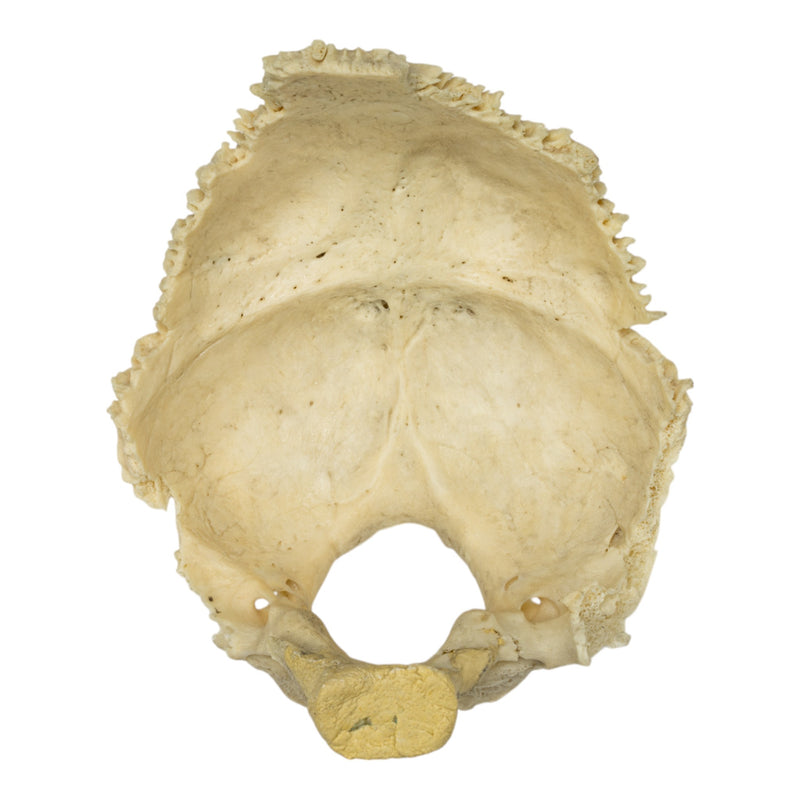 Real Human Occipital Bone - Damaged