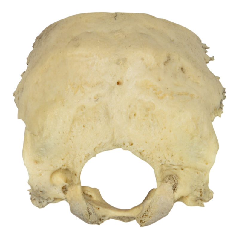 Real Human Occipital Bone - Damaged