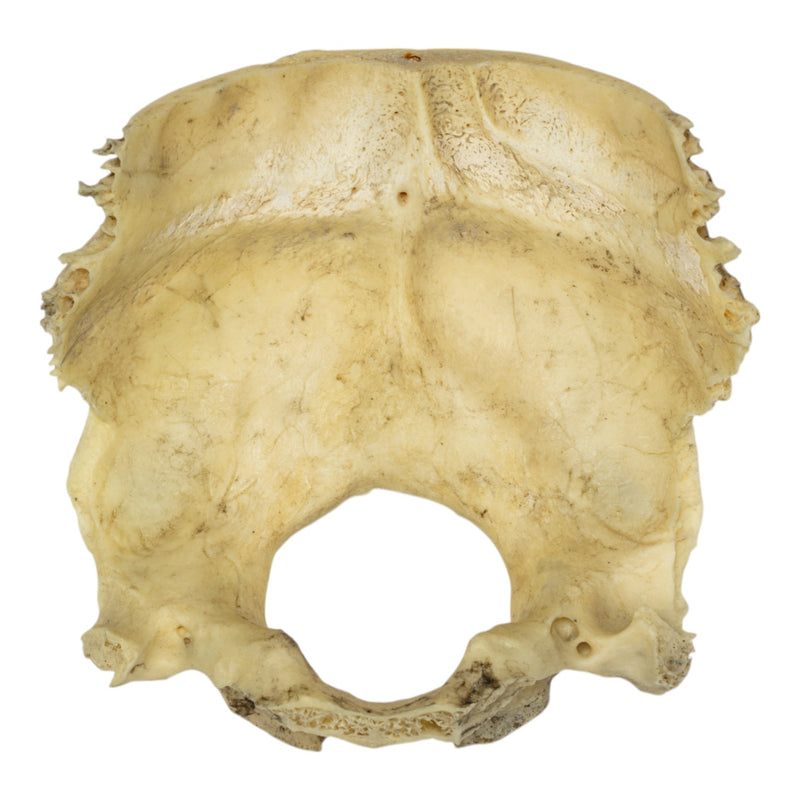 Real Human Occipital Bone - Damaged