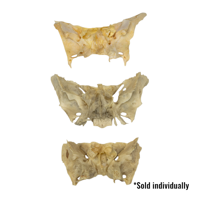 Real Human Sphenoid Bone - Damaged (Single)