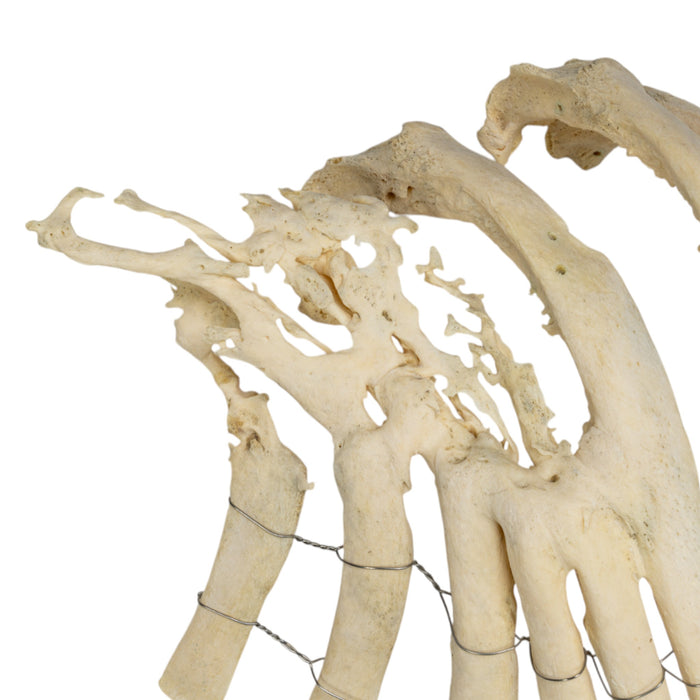 Real Human Ribs - Pathology