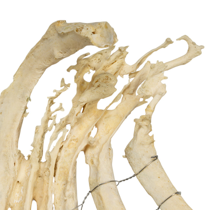 Real Human Ribs - Pathology