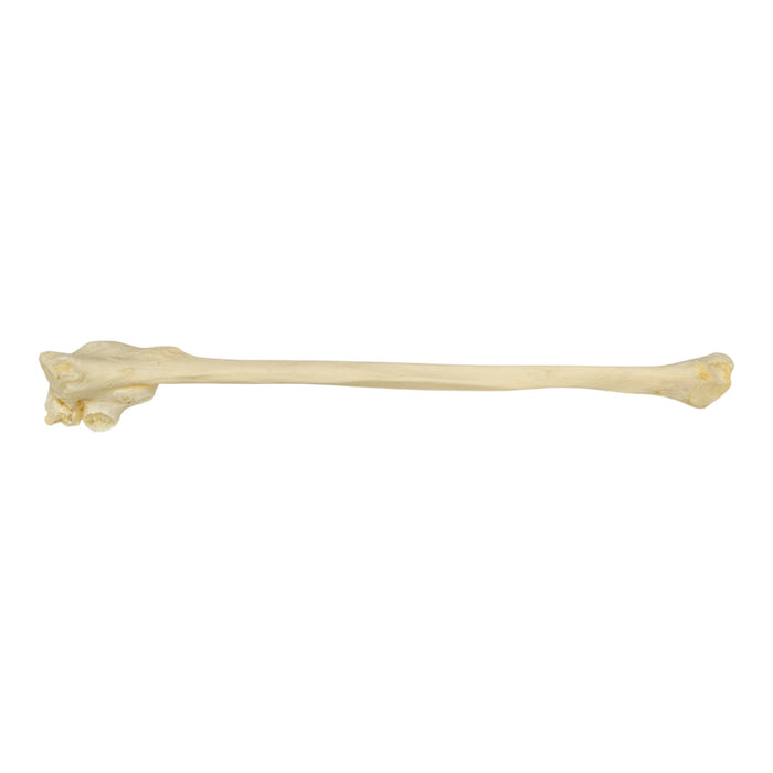Real Human Fibula - Pathology