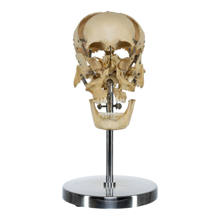 Real Human Exploded Skull on Stand