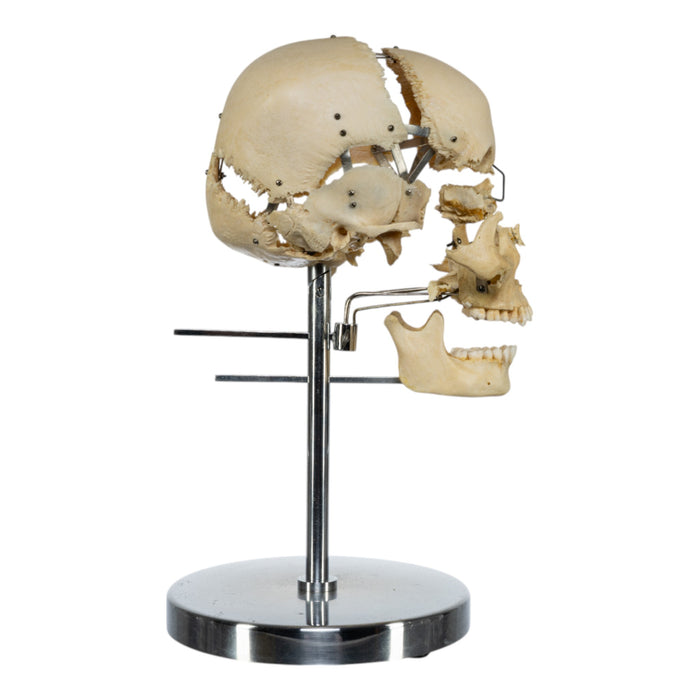 Real Human Exploded Skull on Stand