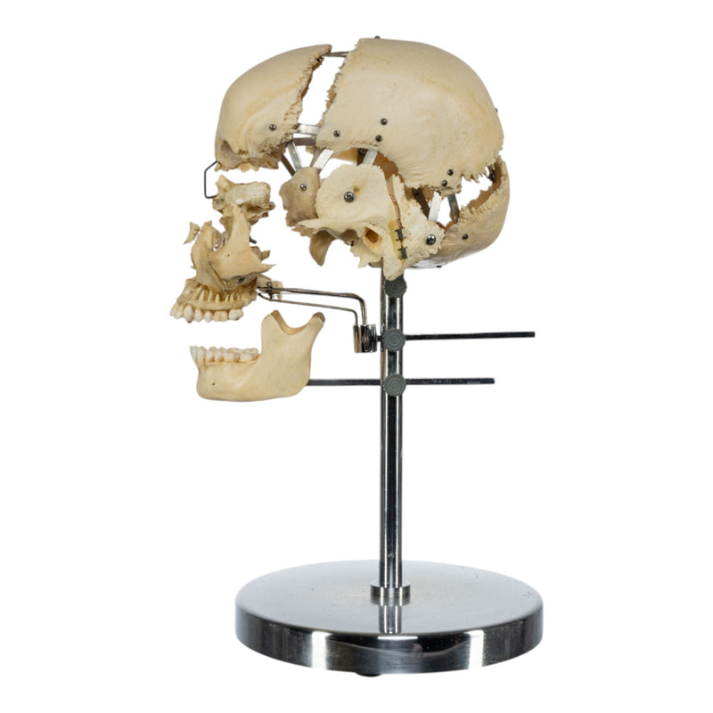 Real Human Exploded Skull on Stand